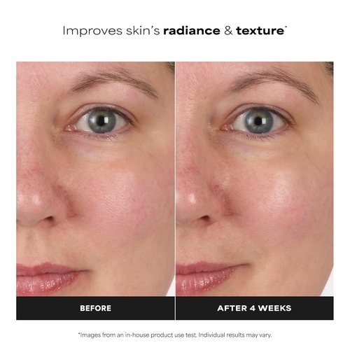 Paula's Choice SKIN BALANCING Face Toner - Pore-Reducing Niacinamide Formula for Oily & Combination Skin, Fragrance-Free