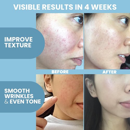 Eva Naturals Collagen Serum - Anti-Aging Multi-Peptide Face Serum with Hyaluronic Acid | Fragrance-Free 2 oz