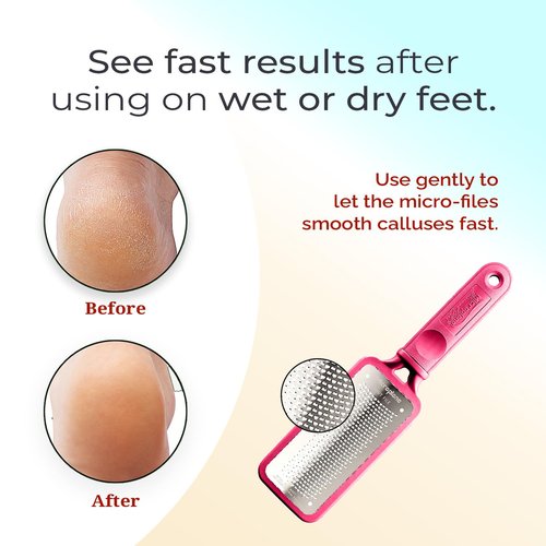 Microplane Colossal Foot File - Original Stainless Steel Callus Remover & Gentle Foot Scrubber | Pink