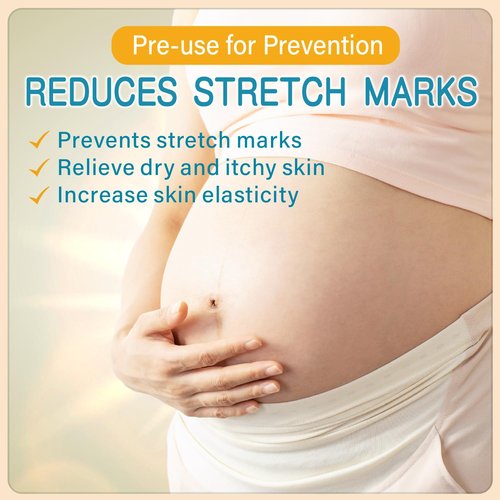 PEGO Stretch Mark Cream - Moisturizing Belly Oil for Pregnancy | Prevent & Reduce Stretch Marks, 300g/10.1 Fl Oz