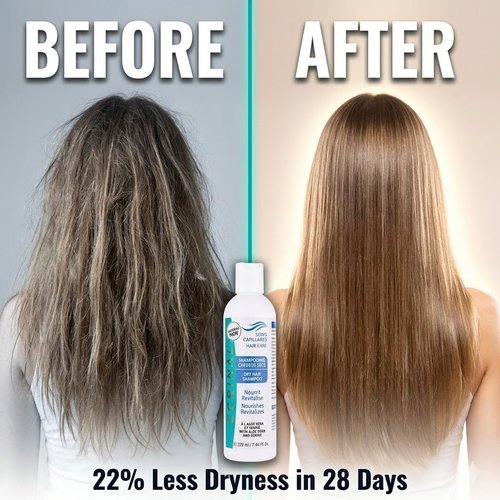 Ecrinal Dry Hair Repair Shampoo - Nourishing Formula for Damaged Hair | 220ml