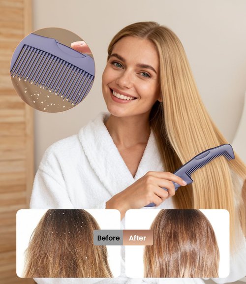 Dandruff Comb | 2PC Upgraded Fine Tooth Scalp Detox Tool for Women, Men & Kids - Purple Hair Care Set