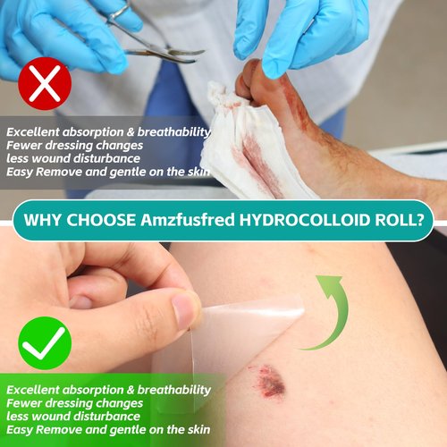 New Hydrocolloid Roll,2in*5ft Hydrocolloid Bandages for Wound Care,Medical-Grade Hydrocolloid Patch Bandages with Self-Adhesive, Flexible & Waterproof DIY Size & Shape (5FT)