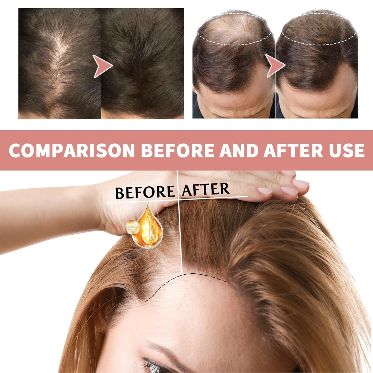 Skiennix Hair Ampoule Treatment - Intensive Lotion for Damaged & Dry Hair | 14 Count