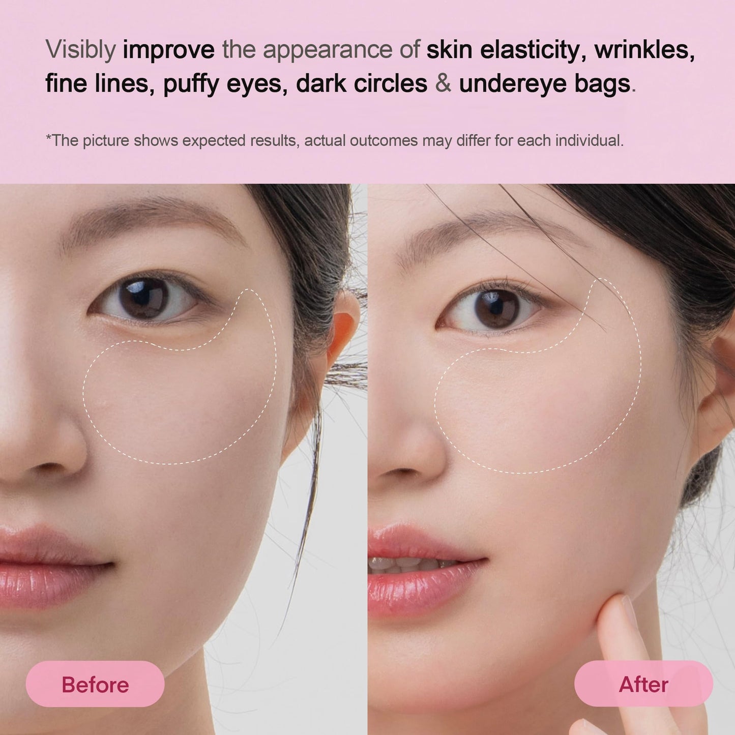 Terez & Honor Under Eye Patches for Dark Circles - 60 Korean Hydrogel Masks for Puffiness, Bags, Wrinkle with Caffeine, Hyaluronic Acid, Niacinamide - Undereye Hydrating & Cooling, Vegan, No Fragrance