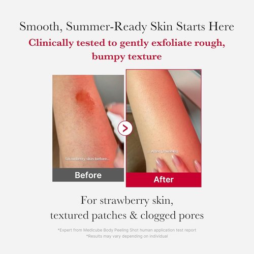 Medicube Red Body Peeling Shot - AHA + BHA Exfoliating Body Spray for Smooth Skin | 3.88 oz