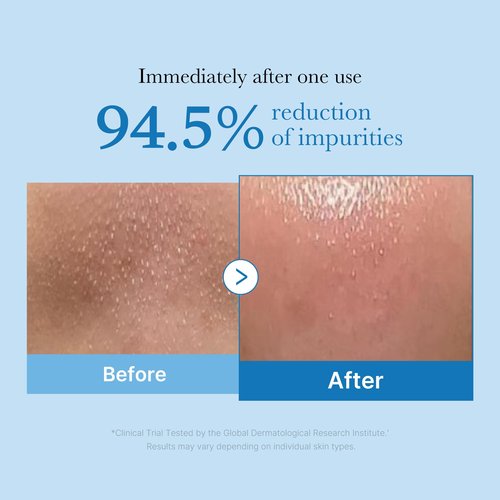 medicube Double Cleansing Duo for Flawless Glass Skin: Zero Pore Blackhead Cleansing Oil and Zero Foam Cleanser, Skin Care Set