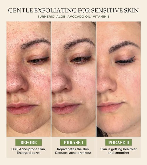 Revitalizing Exfoliation Face Scrub by [Brand Name] - Vitamin C & Turmeric for Blackheads & Dark Spots | 4.23 Fl Oz