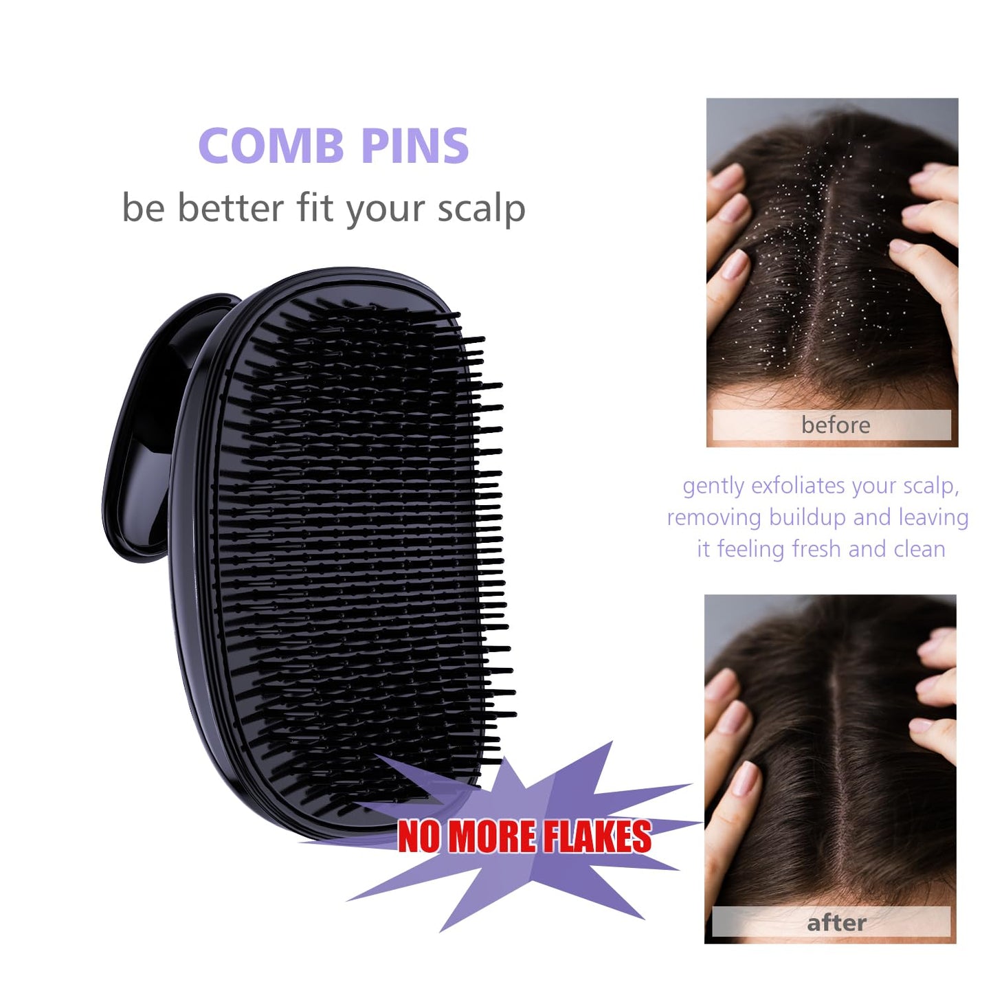 Skiennix 2-in-1 Scalp Massager Shampoo Brush - Exfoliating Dandruff Scrubber for Hair Growth | Black Purple