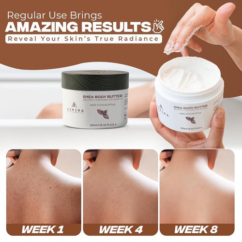 AZMERA Whipped Shea Body Butter - Refreshing Mint & Eucalyptus Moisturizer for Dry Skin | 8.82 oz Vegan Formula
