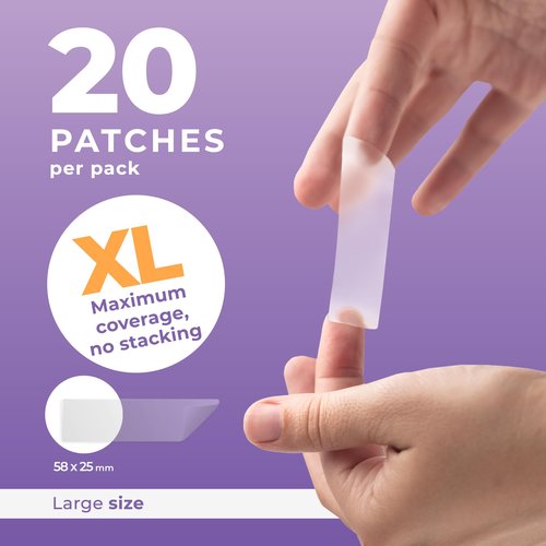 PatchRx Large Pimple Patches for Face (20 Pack), Hydrocolloid Acne Patch, Hydrocolloid Bandages, Big Pimple Patches, Large Acne Patch