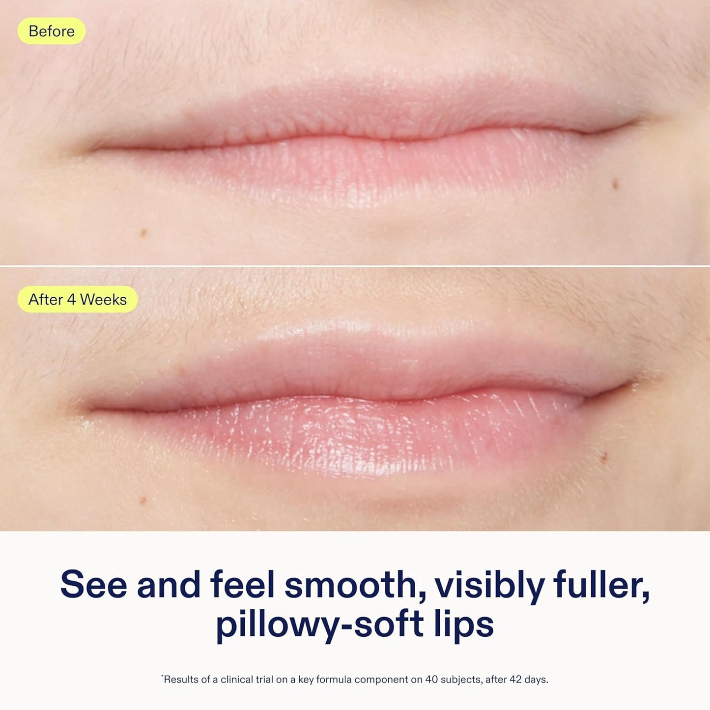 Skinfix Triple Lipid Lip Treatment - Hydrating, Volumizing Balm - Smooths Fine Lines - 0.27 oz - Fragrance Free, Vegan