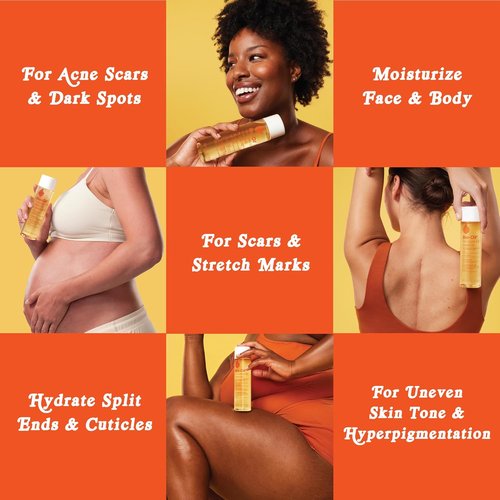 Bio-Oil Natural Skincare Oil - Multi-Purpose Serum for Scars & Stretch Marks | 6.7 Oz
