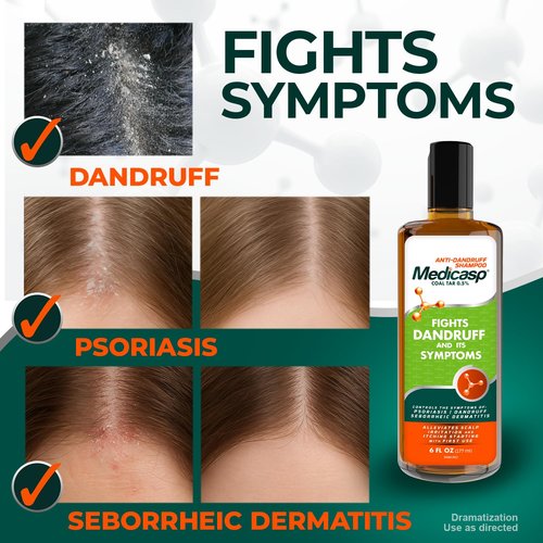 Medicasp Coal Tar Anti-Dandruff Shampoo - Alleviates Itchy Scalp & Treats Psoriasis | 6 Fl Oz