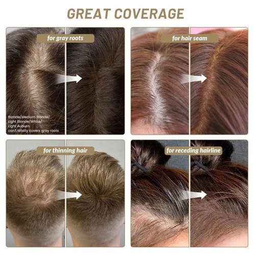 SOVONCARE Hairline Powder - Root Touch Up & Gray Hair Concealer for Men and Women, Instantly Covers Thinning Hair and Bald Spots, Natural-Looking Coverage Dark Black 0.35 oz
