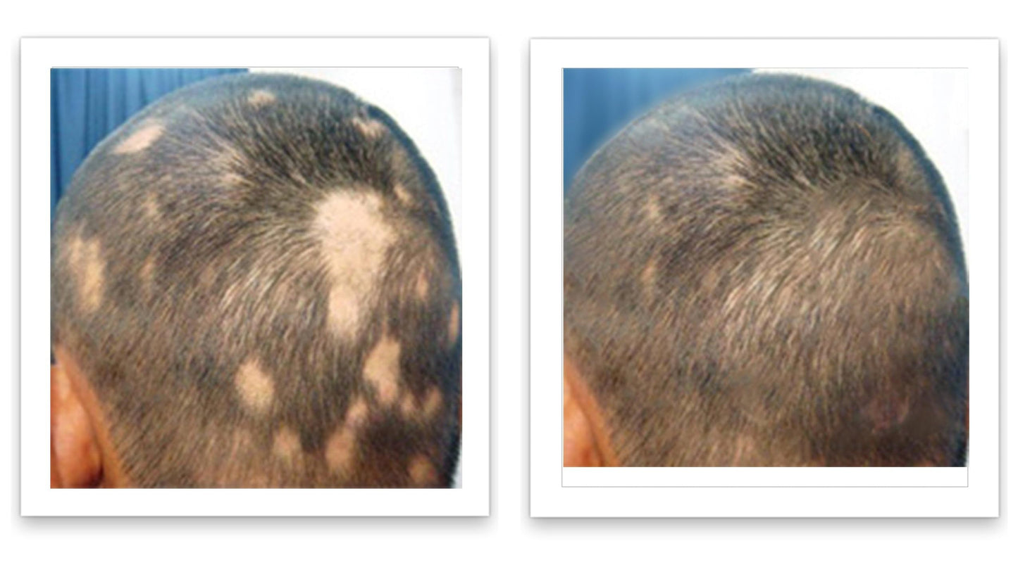 Caboki 10X Hair Powder for Thinning Hair Auburn, TALC-Free, Healthful Formula, Instant Fuller Hair, Flawless Roots, Rain and Sweat Resistant, Easy to Use, Men Women