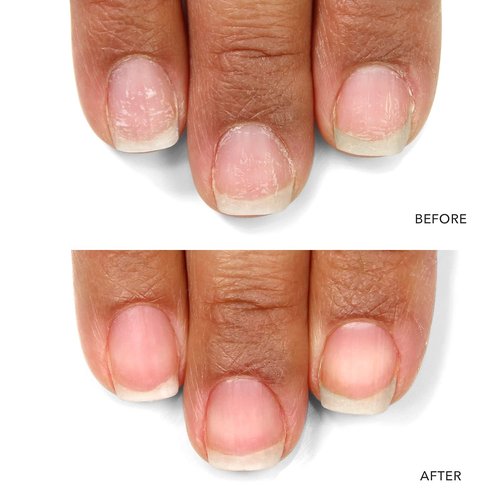 LONDONTOWN Kur Nail Probiotic | Instant Boost Nail Care Mask for Weak, Thin Nails - Hydration & Protection