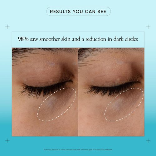 Philosophy Dose Of Wisdom Eye Cream - Brightening & Hydrating Formula with Hyaluronic Acid, Vitamin C & Caffeine - 0.5 Fl Oz