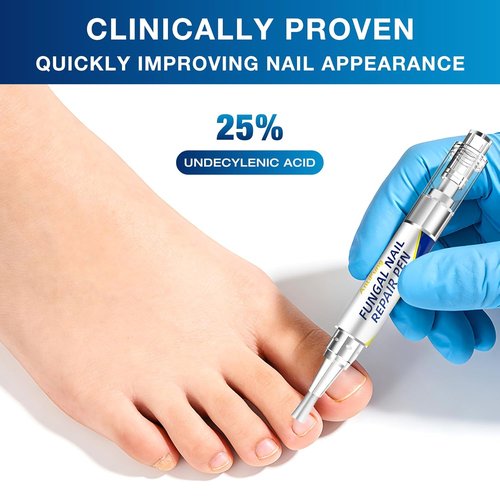 AntiFung Pen by Toenail Fungus Treatment - Extra Strength with 25% Undecylenic Acid - 3-Pack for Effective Nail Repair