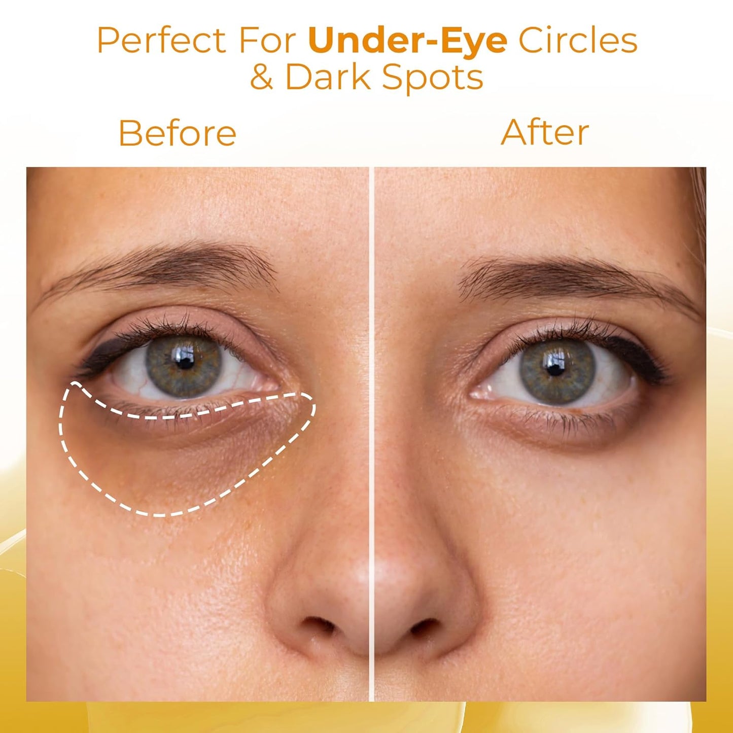 Yellow Corrector Powder by [Brand Name] - Concealer for Redness & Dark Circles | Talc-Free, Vegan, 5g Jar