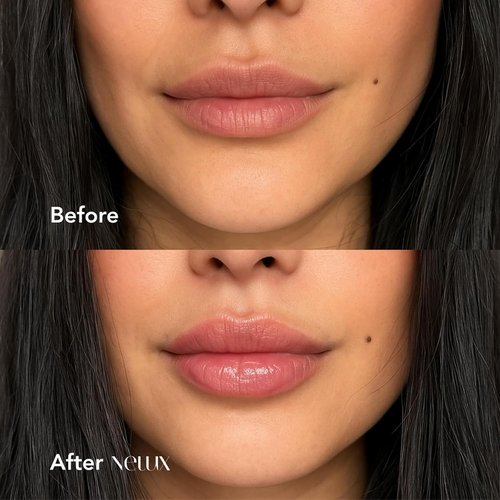 Nelux Hyaluronic Acid Lip Plumper - Instant Hydration & Fullness | Non-Sticky, Smooth Finish