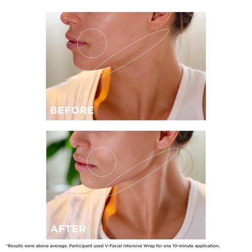 Clarins V-Facial Intensive Wrap Face Mask - Award-Winning Contouring Mask | Reduces Puffiness & Swelling | 2.5 Oz