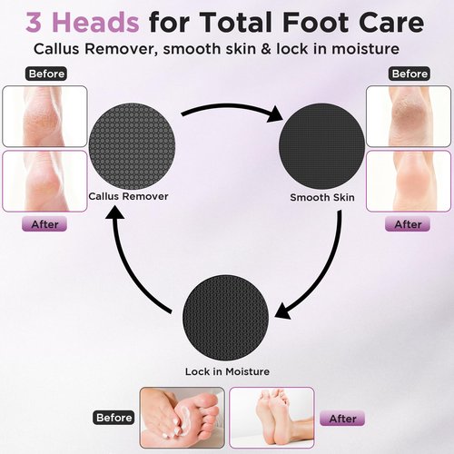 Electric Foot Callus Remover, Apply Oil,Foot SPA,Foot File,Reusable Nano-Glass Head, Ergonomic Premium Aluminum Callus Remover for feet, Rechargeable Pedicure Tools for Feet,Gifts for Men Women
