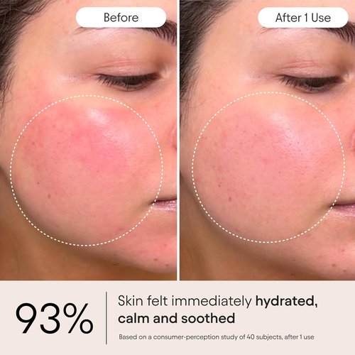 Alpyn Super Peptide Moisturizer - Ghostberry Formula for Eczema Relief & Wrinkle Repair | 1.7 oz / 50 ml