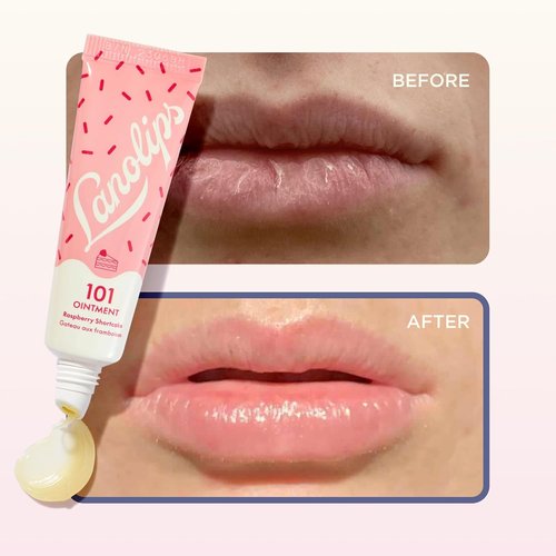 Lanolin 101 Multipurpose Ointment - Healing Lip Balm & Skin Moisturizer - Raspberry Shortcake (0.35 oz)