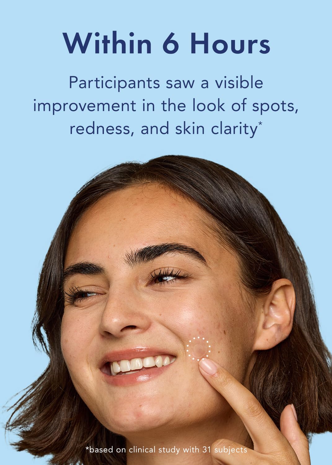 Rael Pimple Patches, Miracle Invisible Spot Cover - Hydrocolloid Acne Pimple Patch, Absorbs Zits & Blemish, Korean Skin Care, 2 Sizes (96 Count)