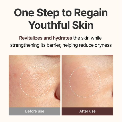 CENTELLIAN 24 PDRN Firming Boosting Ampoule - Enhance Skin Elasticity with 300,000 ppm PDRN | 1.01 fl oz