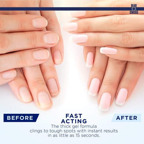 Blue Cross Cuticle Remover Gel - Hydrating Cuticle Softener for Brittle Nails | 8oz Citrus Made in USA