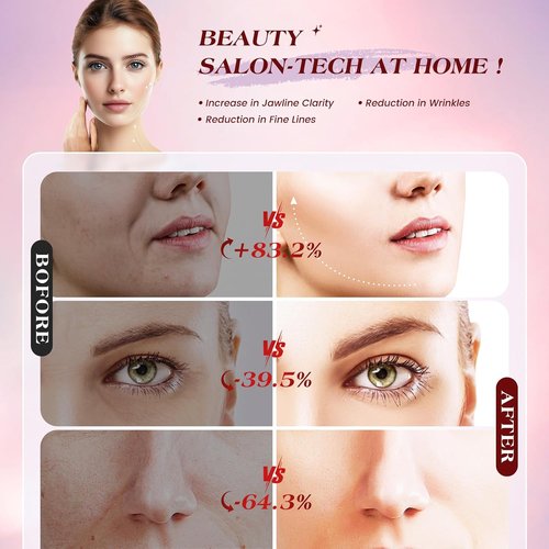 INTEO Microcurrent Facial Device - 3 Modes Red Light Therapy for Face & Neck | Gold Skin Care Massager