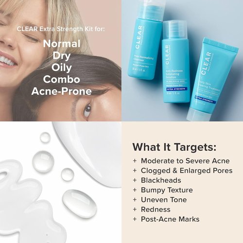 Paula's Choice CLEAR Acne Treatment Kit - Daily Cleanser, 2% Salicylic Acid & Benzoyl Peroxide | Fragrance-Free, 3-Piece Set