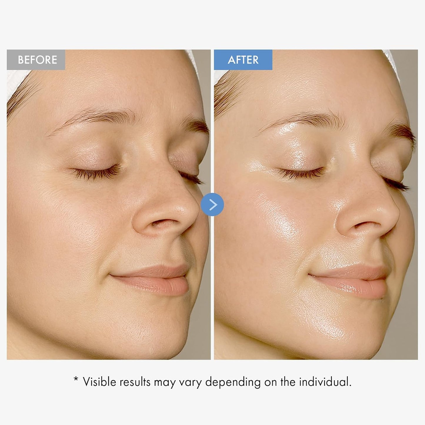 TOSOWOONG Hyaluronic Acid Cream - Long-Lasting Hydration with Vitamin B5 & Collagen | 50ml