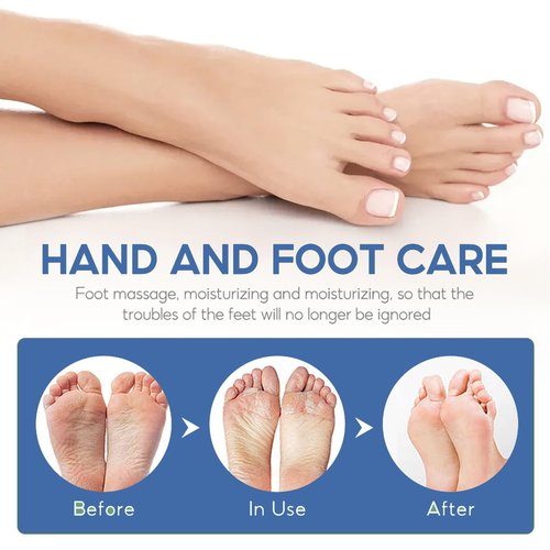 Rosarden Feet Cream for Dry Cracked Feet, 40% Urea Cream, Callus Remover Cream for Feet, Heels, Knees, Elbows, Hand, Moisturizing Foot Cream Softening Rough Skin On Feet, Rough Exfoliates Calloused