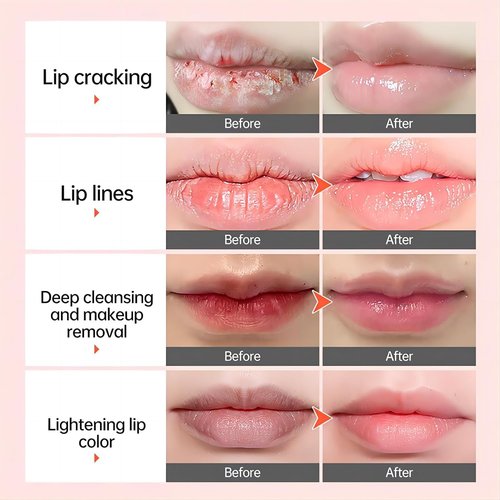 Natural Lip Lightening Balm with Hyaluronic Acid | Exfoliates Dead Skin, Fades Discoloration, Moisturizing for Smokers, Men & Women
