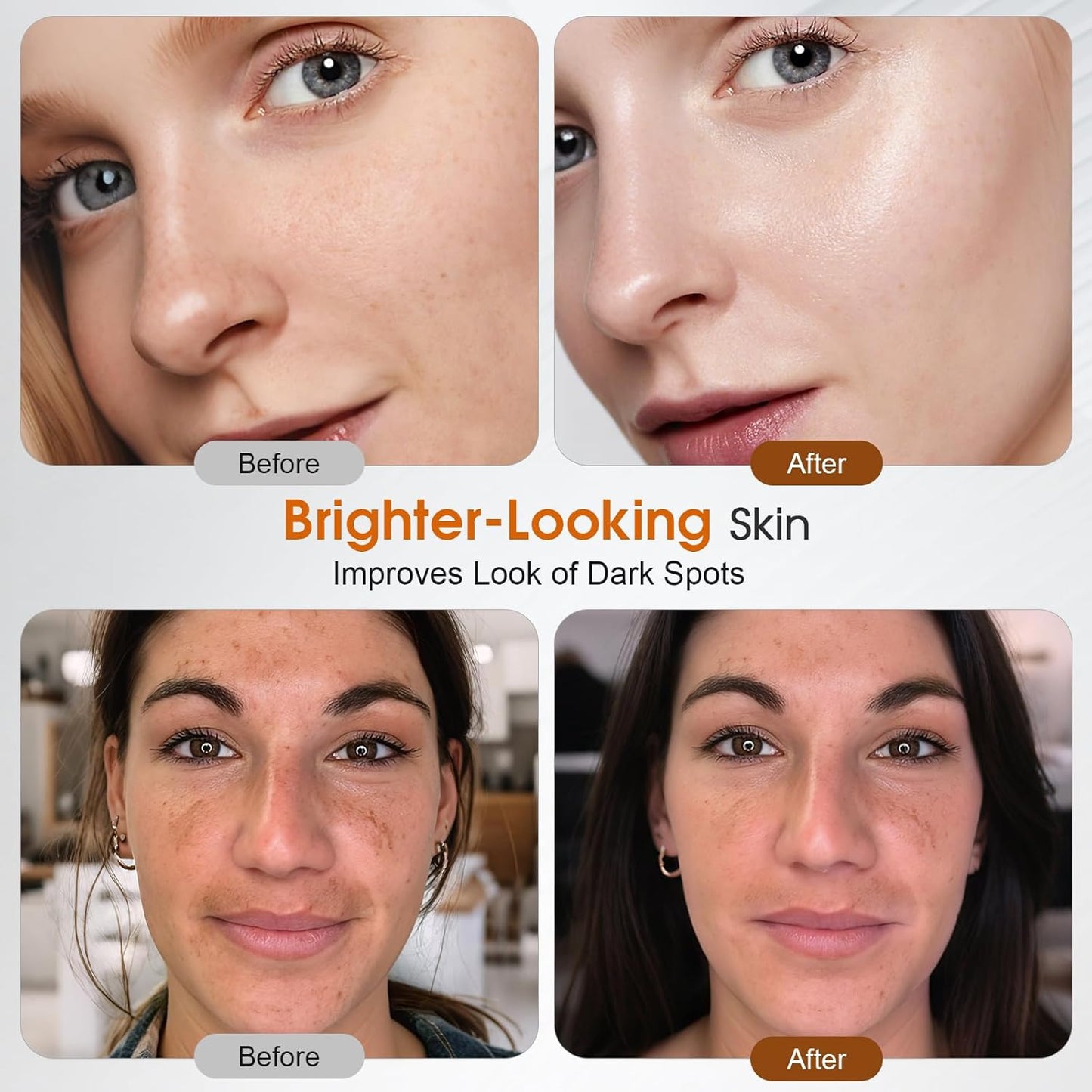 Skiennix Vitamin C Complex Brightening Serum - Fades Dark Spots, Evens Skin Tone & Smooths Skin for Radiant Glow