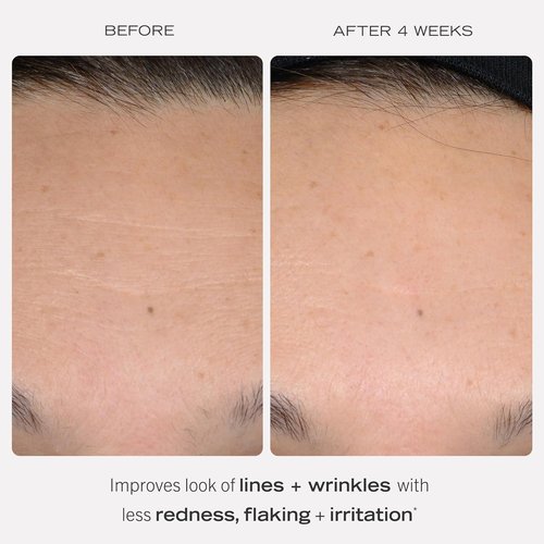 First Aid Beauty - Retinol Complex Serum with Peptides for Sensitive Skin | Reduces Lines & Wrinkles, 1 oz
