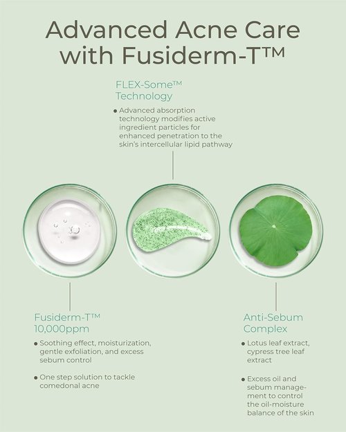Fusiderm-T Derma Trouble Balancing Cream - Lightweight Acne Moisturizer | 1.7 fl oz Hydrating Formula