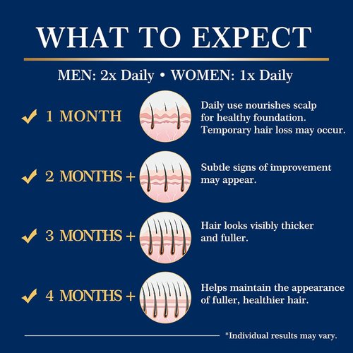 Regine Switzerland 5% Minoxidil Hair Growth Spray Kit - Extra Strength Treatment for Thinning Hair & Beard - 2PCS