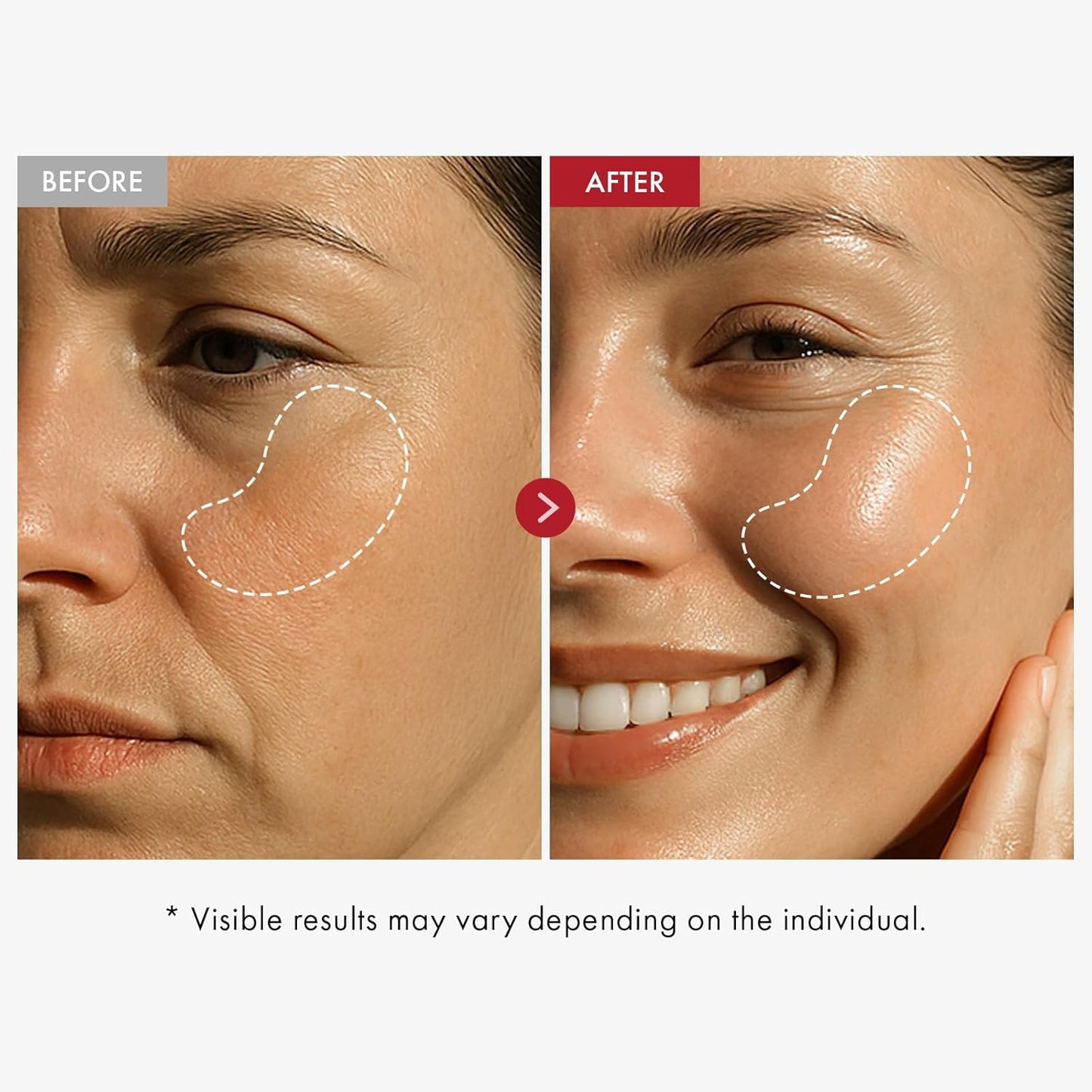 TOSOWOONG Real Collagen Face Cream - Firming & Lifting Moisturizer with Hyaluronic Acid | 50ml