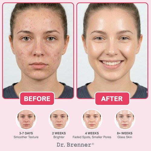 Regine Switzerland Niacinamide Serum 10% - Dark Spot Corrector with TXA, Zinc & Arbutin for Bright, Even Skin