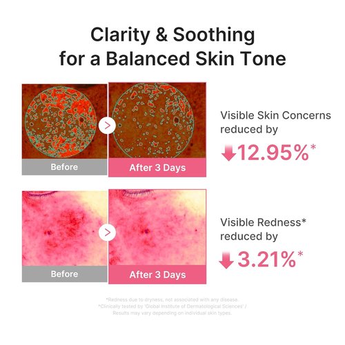 Medicube Ultra Light PDRN Pink Peptide Serum - Lightweight Hydrating Formula with Salmon PDRN & Hyaluronic Acid | Fast-Absorbing Glow Care for Skin Clarity | 1.01 fl. oz.