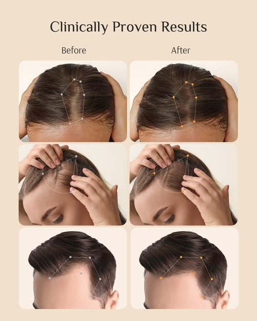 DR ZERO Hair Growth Serum - 3% Redensyl Treatment for Thinning Hair & Scalp Care, 60ml