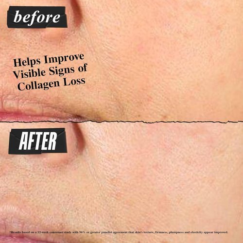 Kiehl's Super Multi-Corrective Cream - Anti-Aging Face & Neck Cream, Evens Skin Tone, Lightweight & Fast-Absorbing