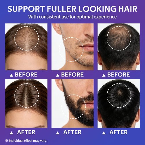 Hair Growth Serum Spray with Rosemary Oil, Biotin & Caffeine, Fast Absorbing Non-Greasy Scalp Serum for Fuller-Looking Hair, Alcohol-Free Nourishing Scalp Spray for Women & Men, 60ml