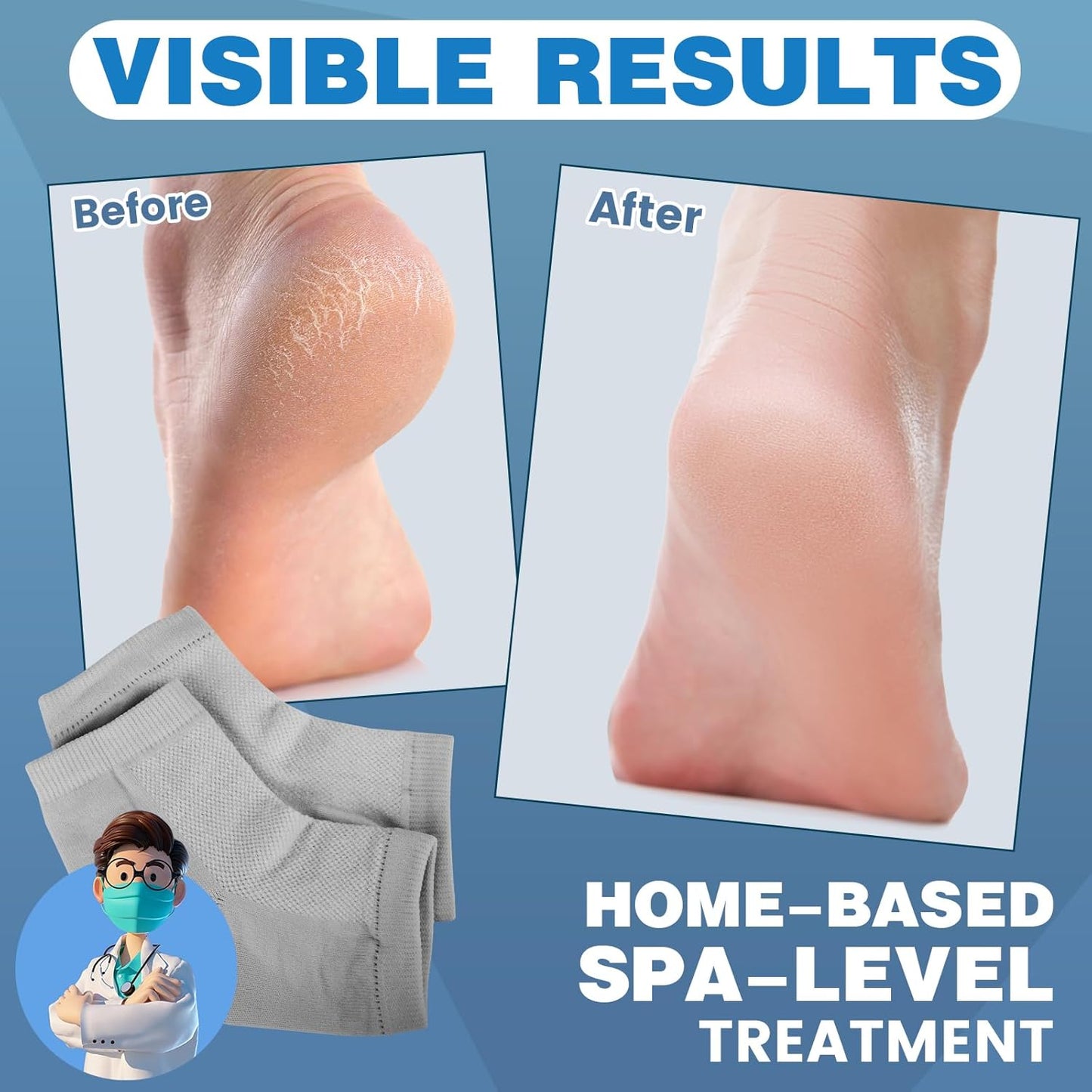 TEAWOO Moisturizing Heel Socks - 6 Pairs of Toeless Gel Socks for Hydrated, Soft Feet