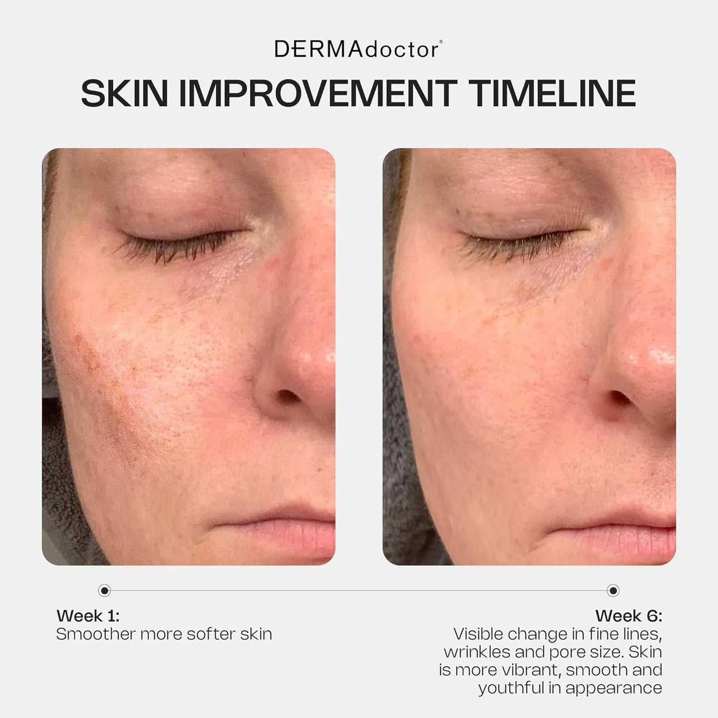 DERMAdoctor Retinol Cream - Anti-Aging Facial Moisturizer with Vitamin C & E | 1% Retinol for Dullness & Fine Lines