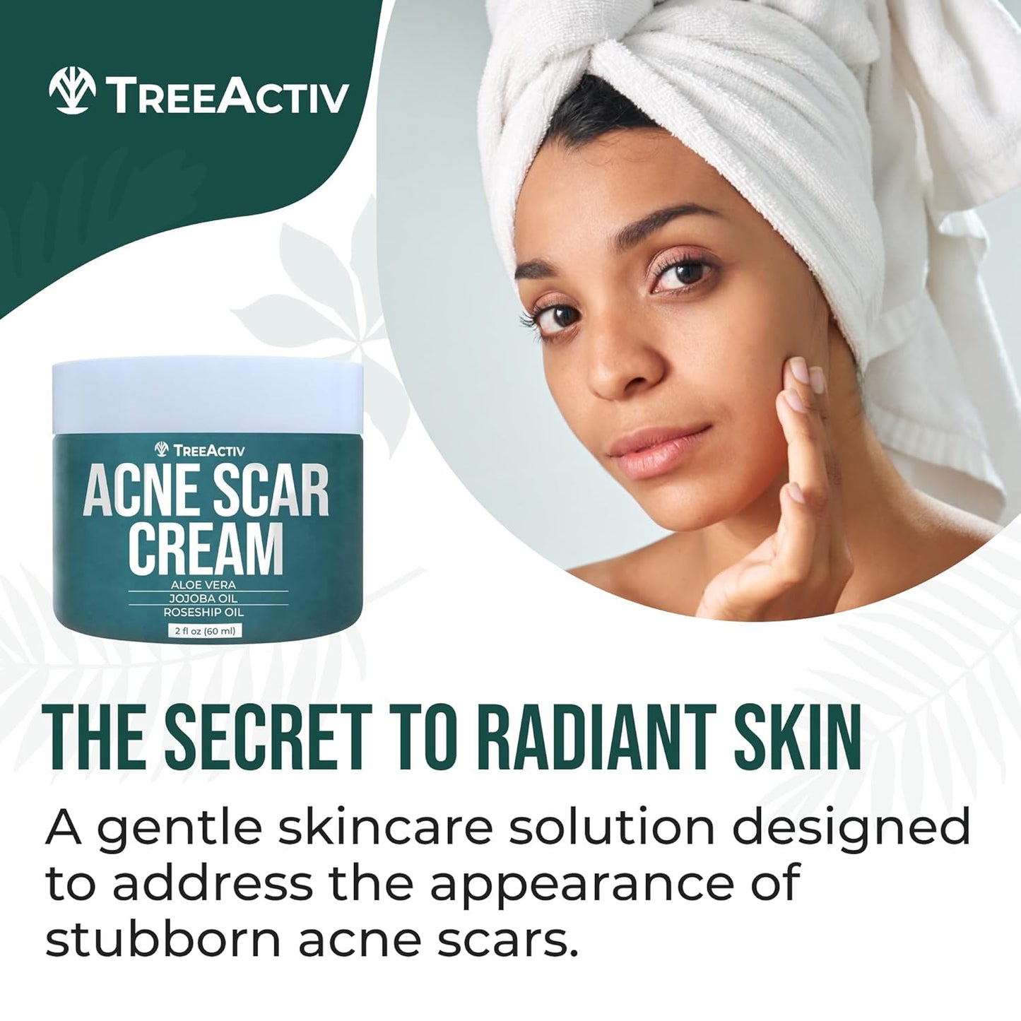 TreeActiv Acne Scar Cream - Dark Spot Remover & Stretch Mark Lotion | 2 fl oz for All Skin Types
